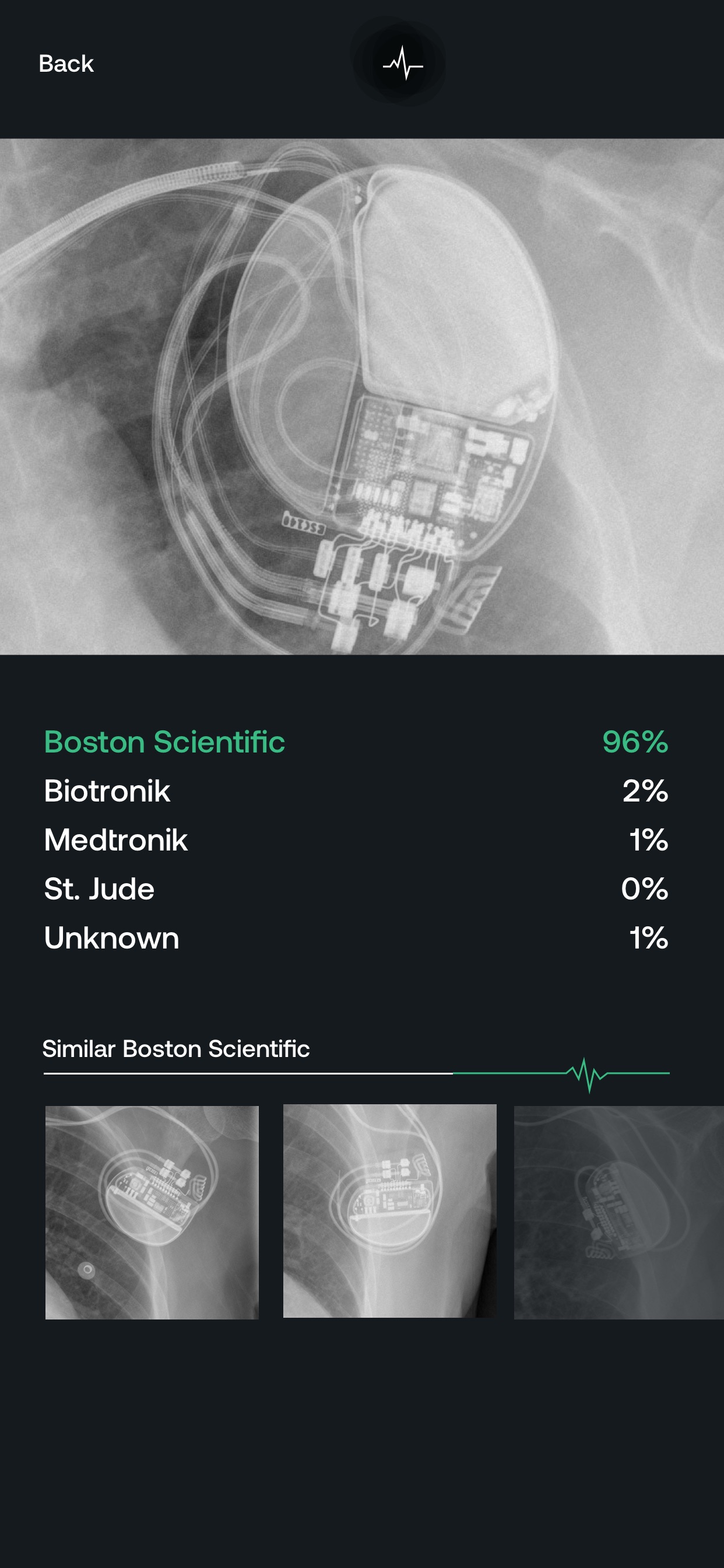 Pacemaker App Store screenshot: listing design